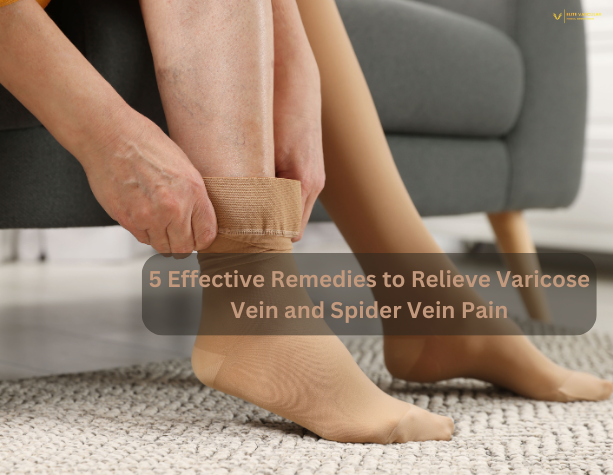 5 Effective Remedies to Relieve Varicose Vein and Spider Vein Pain