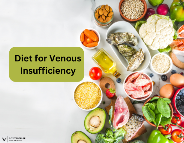 Diet for Venous Insufficiency