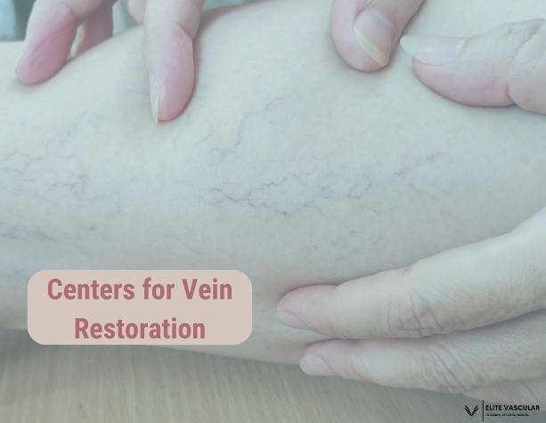 Centers for Vein Restorations