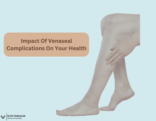 Impact Of Venaseal Complications On Your Health