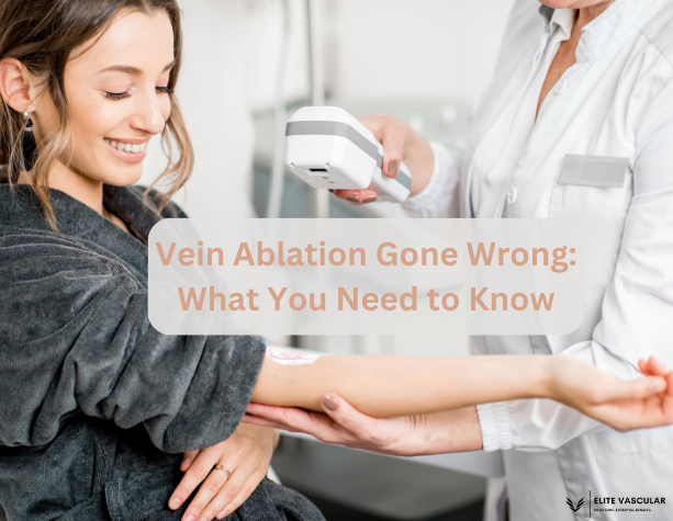 Vein Ablation Gone Wrong