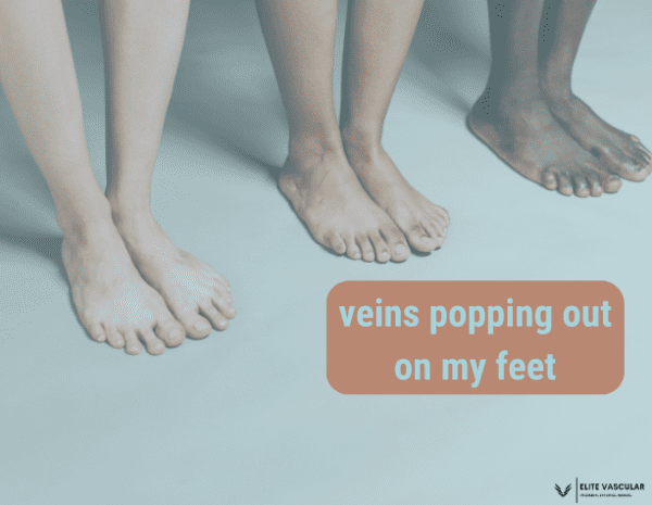 Why Are My Veins Popping Out On My Feet?