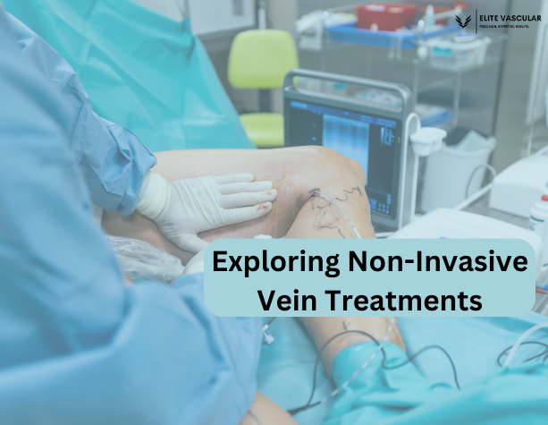Exploring Non Invasive Vein Treatments