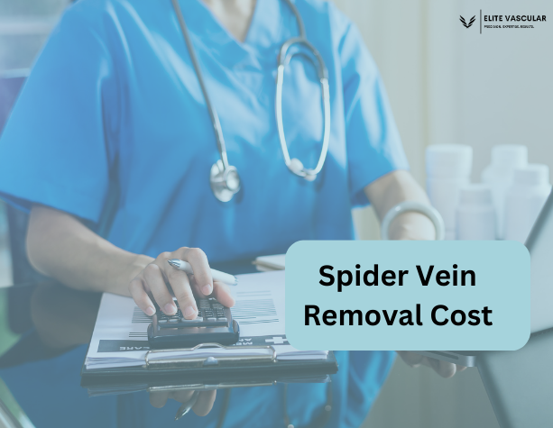Spider Vein Removal Cost