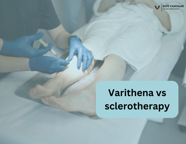 Varithena vs sclerotherapy