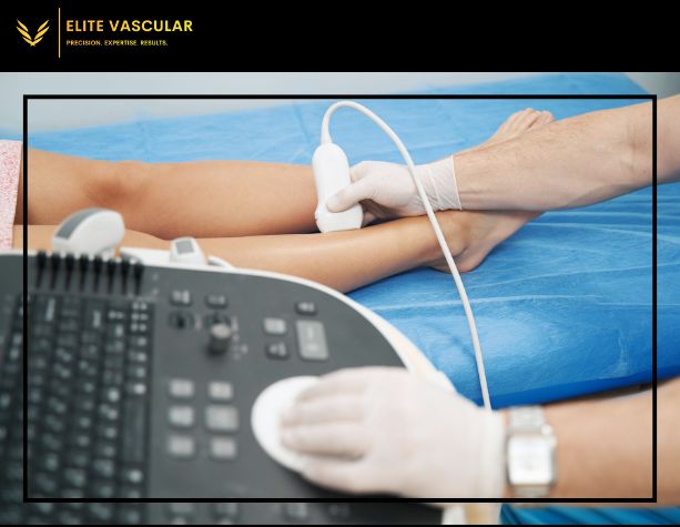How Vein Specialists Diagnose and Treat Vein Conditions