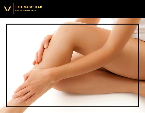 Can Varicose Veins Cause Heavy, Aching Legs