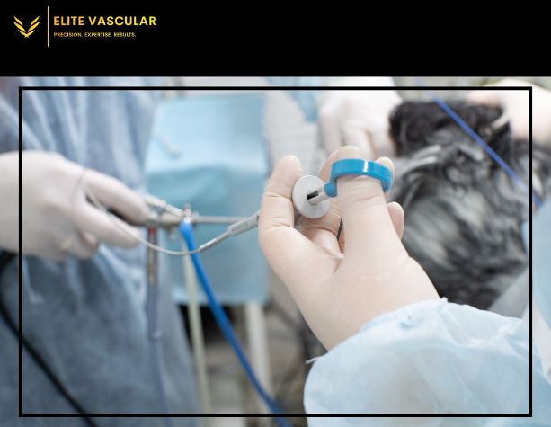 Endovenous Ablation Explained: A Modern Solution For Vein Health