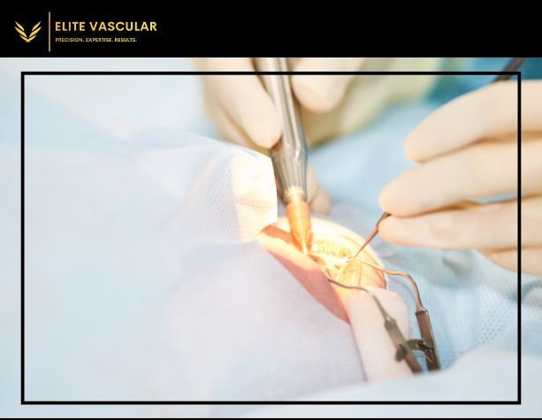 Laser vein treatment being performed by a trained specialist.