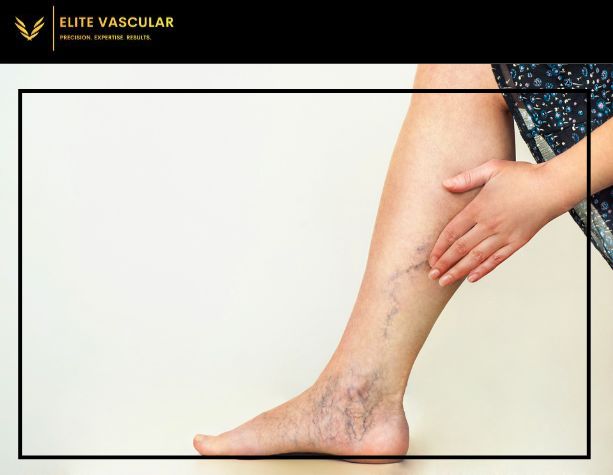 Why Do Some People Have Blue Veins and Others Have Green Veins?