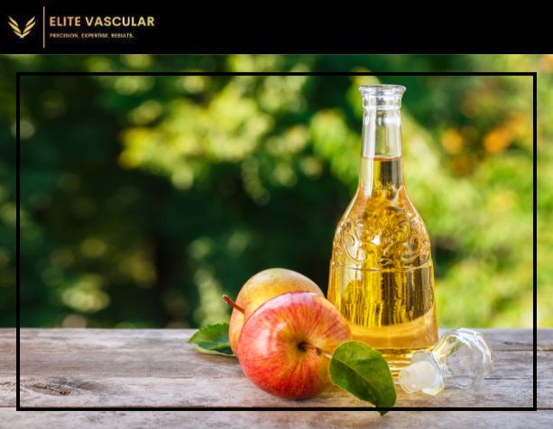 apple cider vinegar for varicose veins