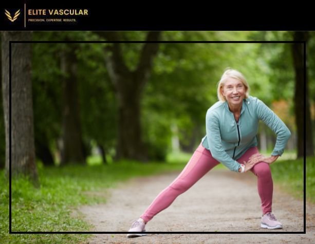 can spider veins disappear with exercise