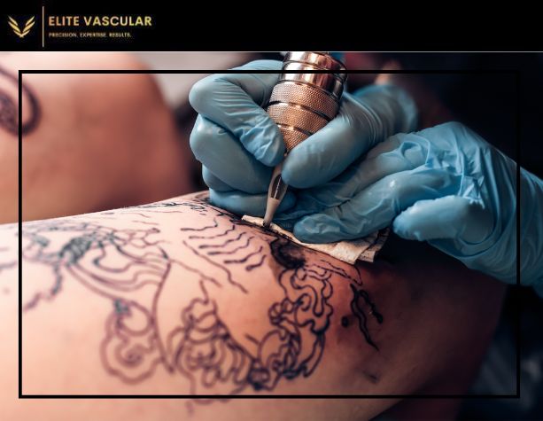 can you tattoo over varicose veins