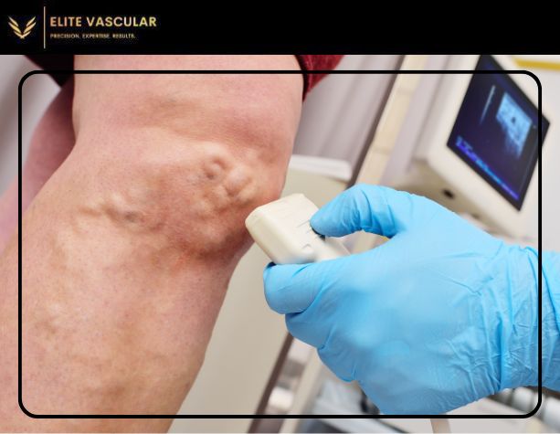 The Role of Ultrasound in Diagnosing Vascular Conditions