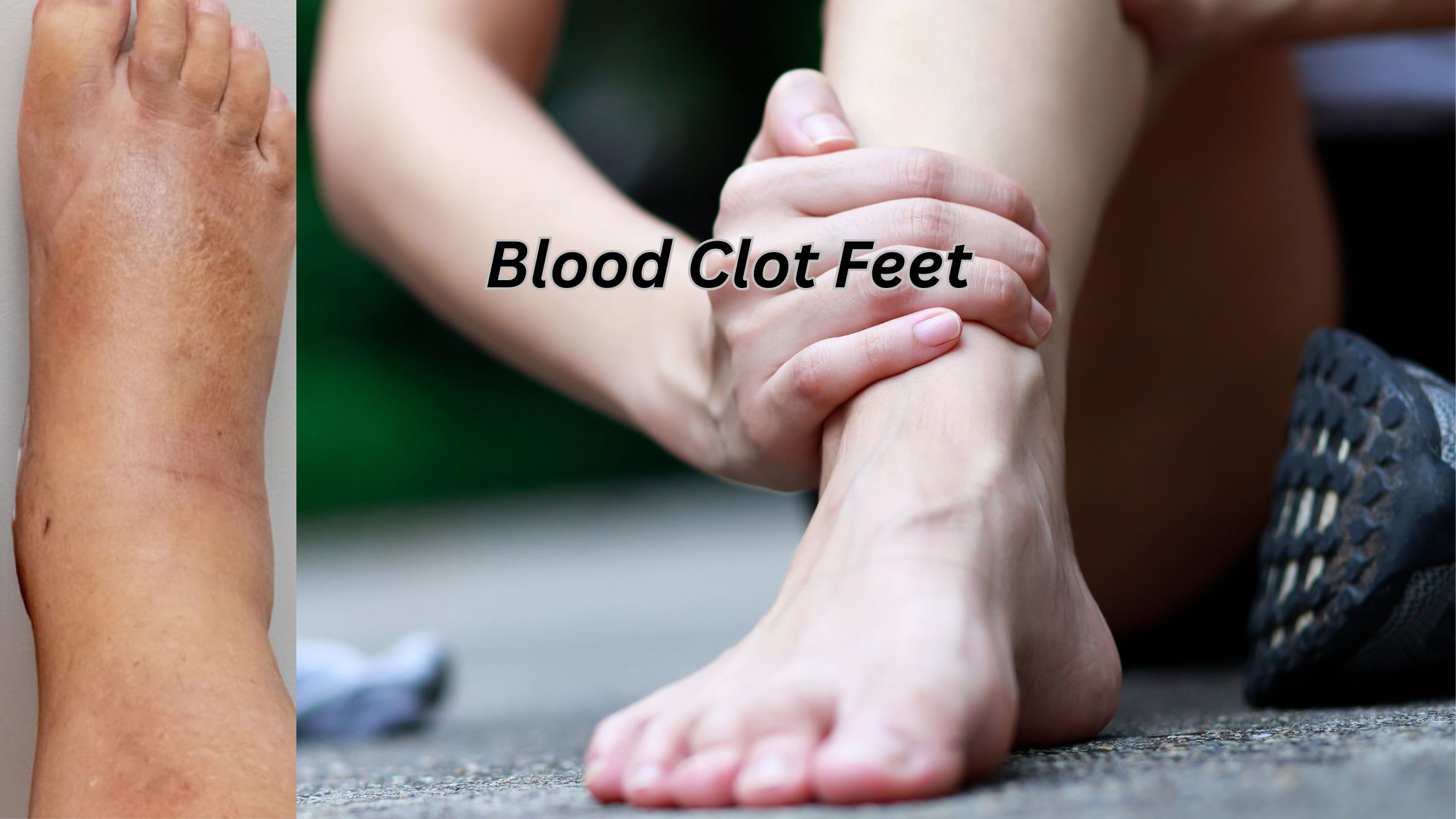 Blood Clot Feet
