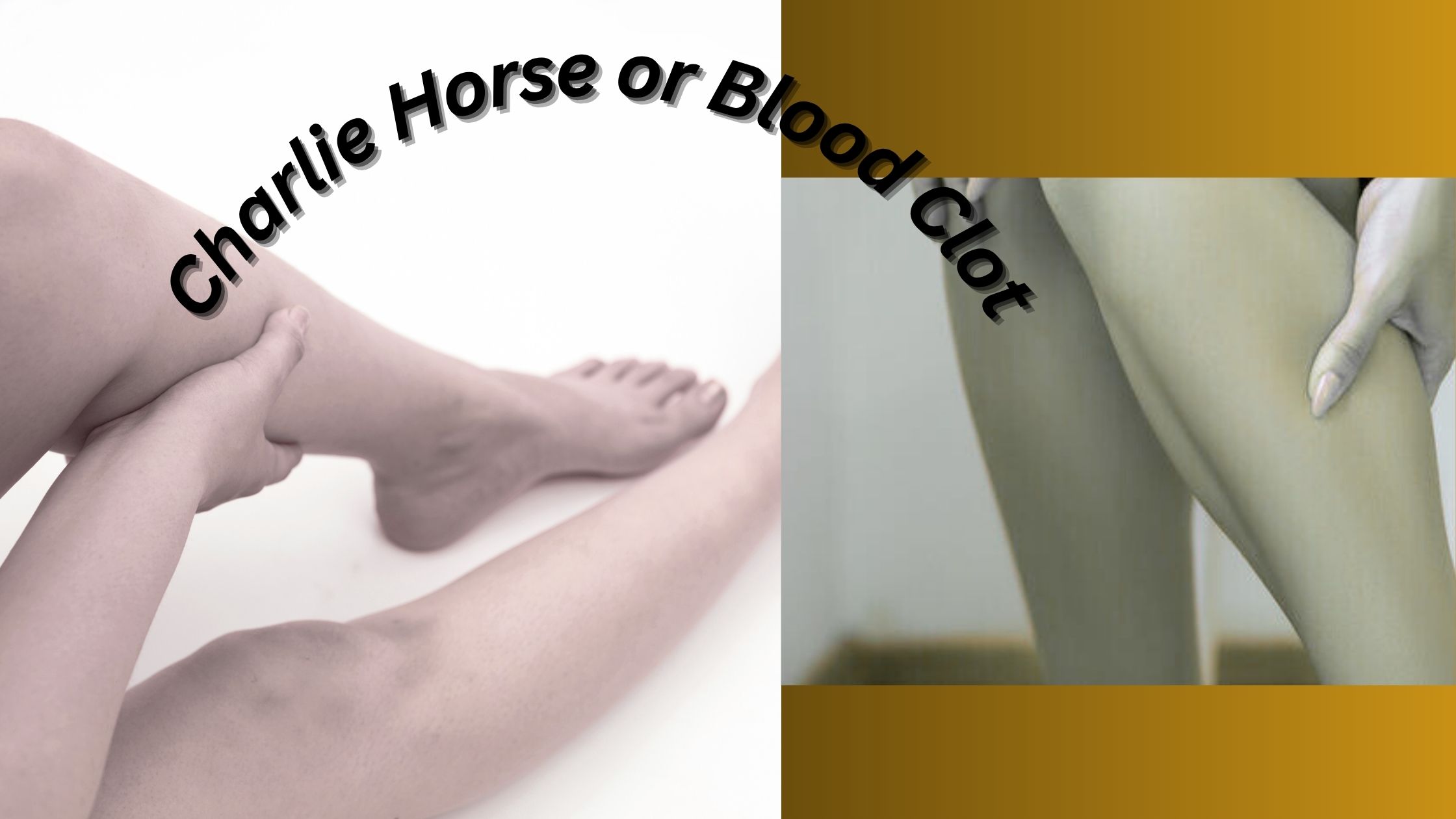 Charlie Horse or Blood Clot