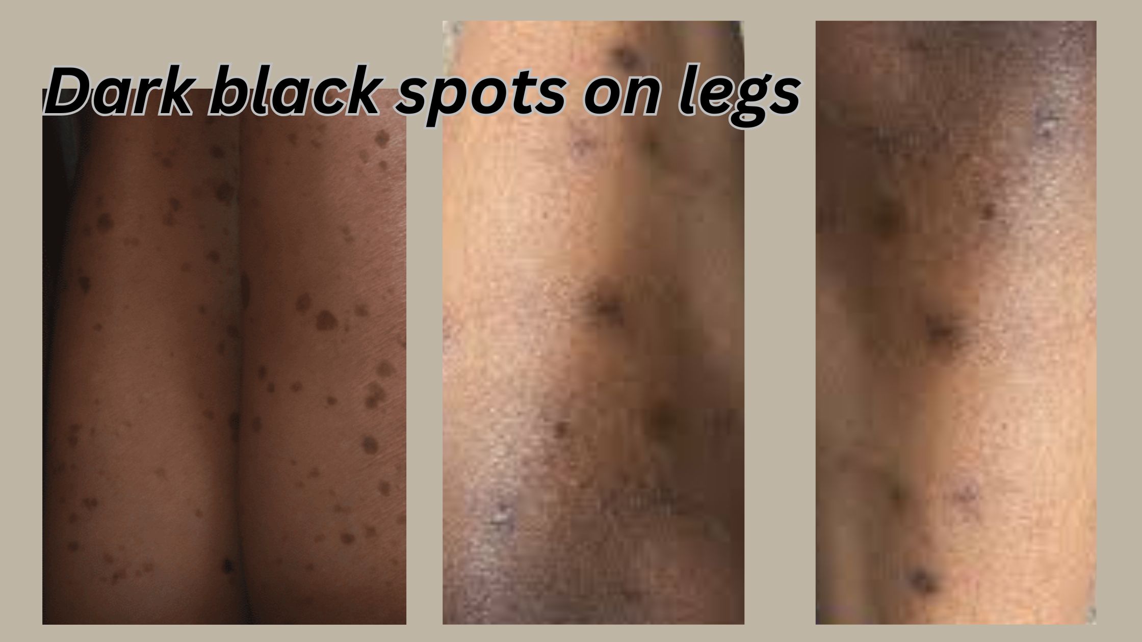 Dark black pots on legs