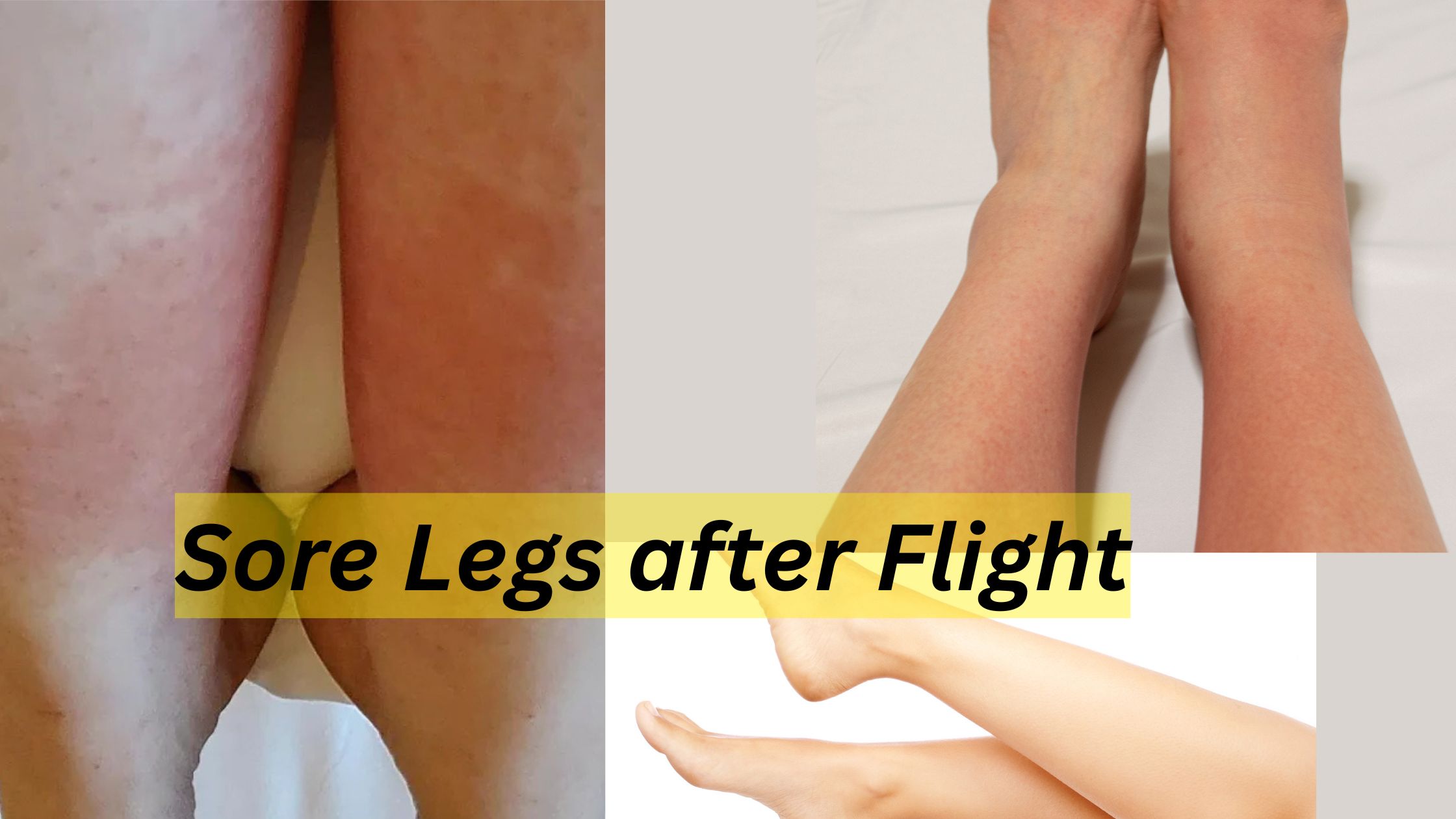 Sore Legs after Flight
