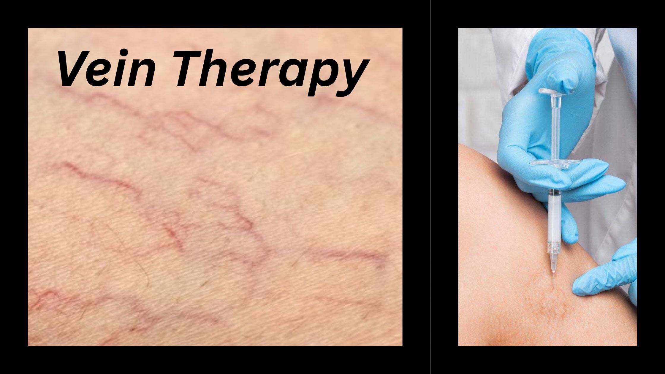 Elitevs Vein Clinic Elmwood Park, NJ