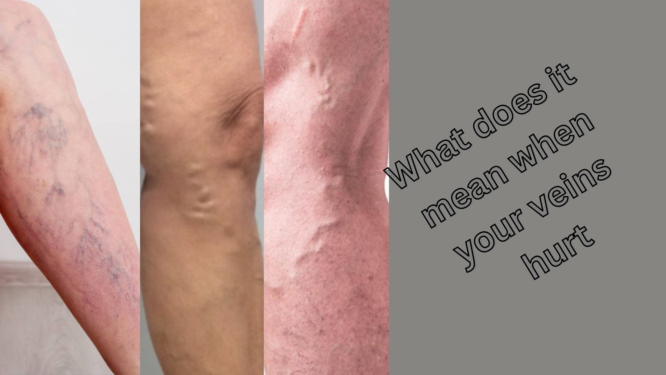 What does it mean when your veins hurt