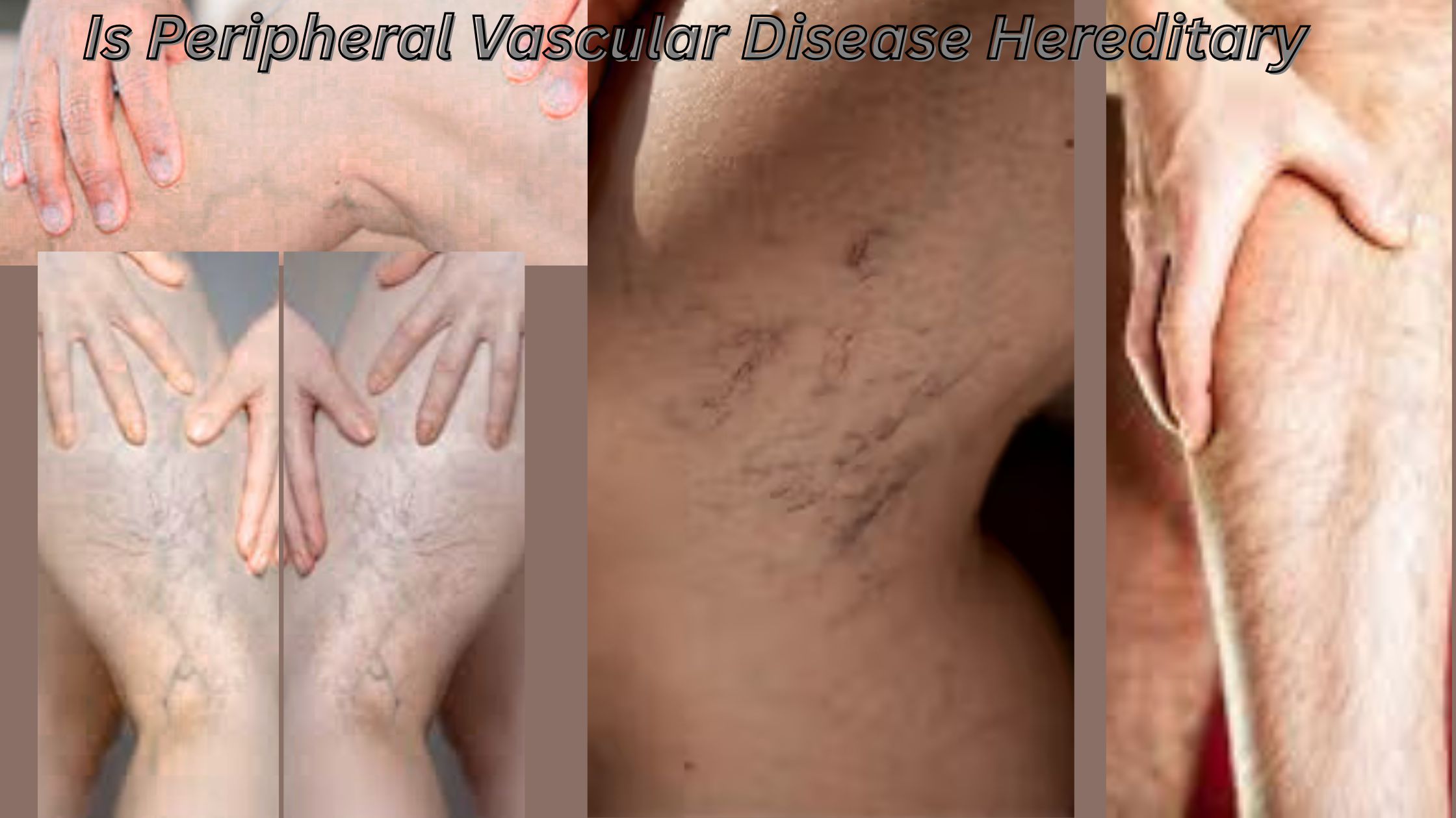 Is Peripheral Vascular Disease Hereditary