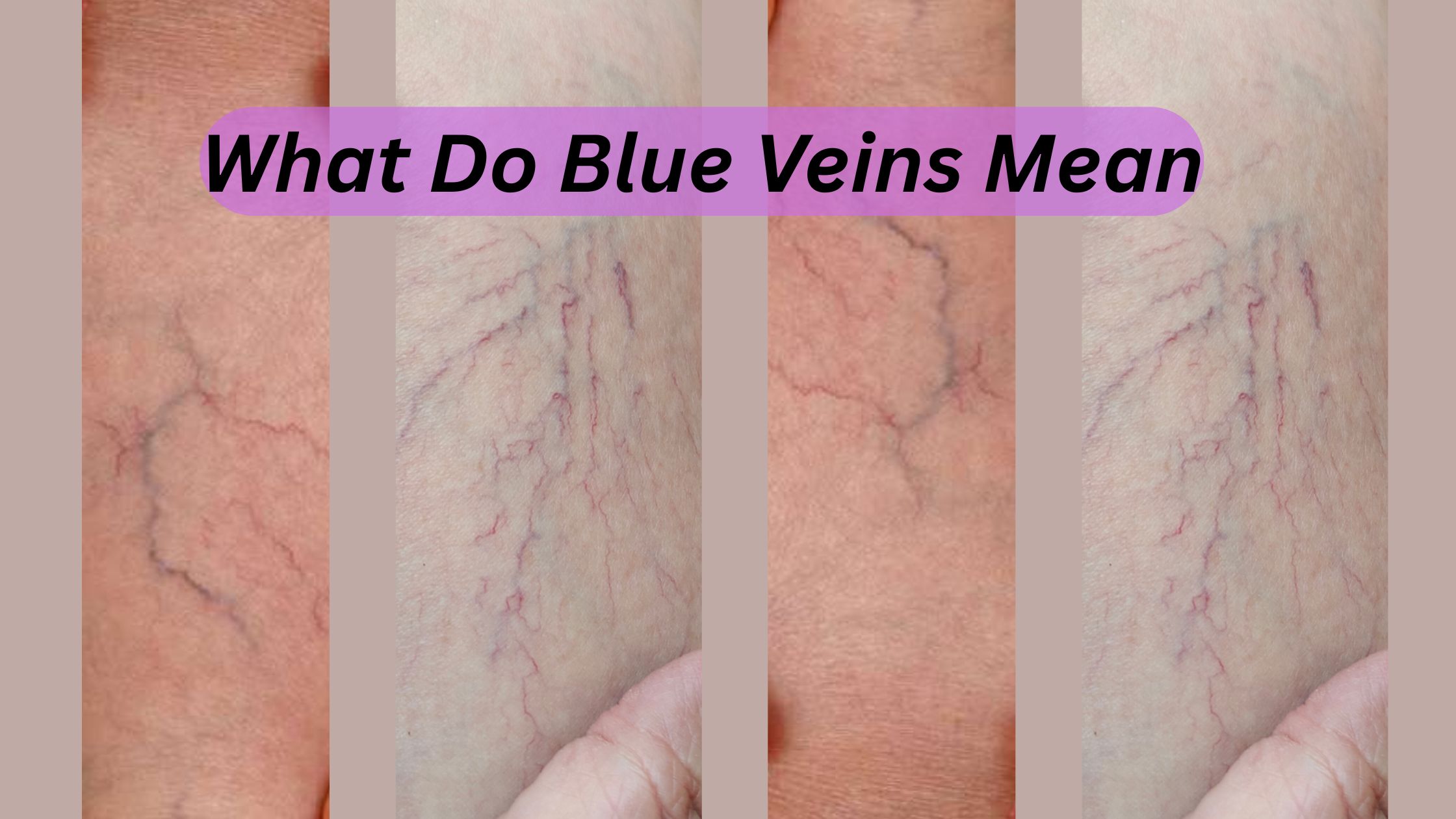 What Do Blue Veins Mean
