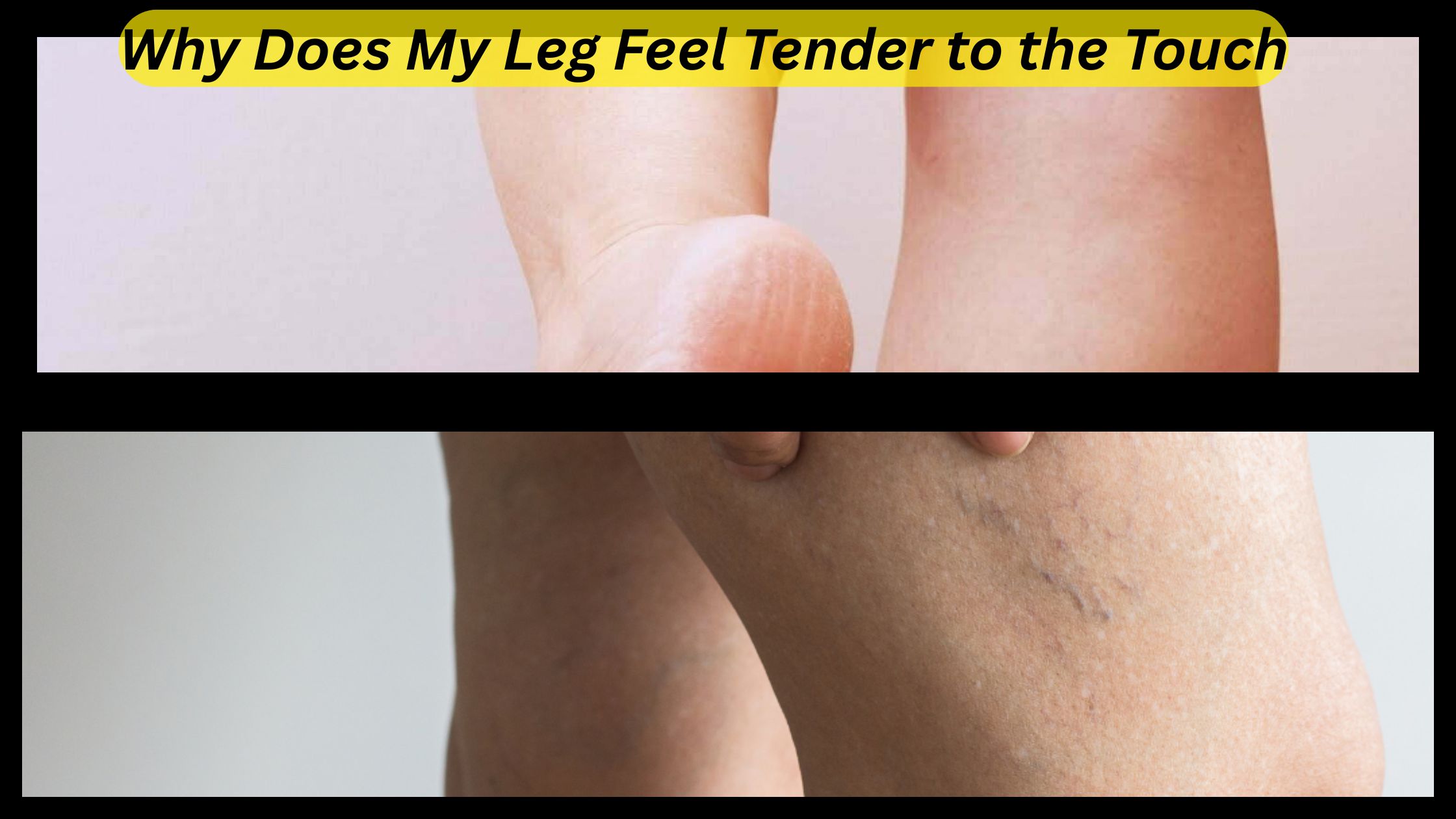 Why Does My Leg Feel Tender to the Touch