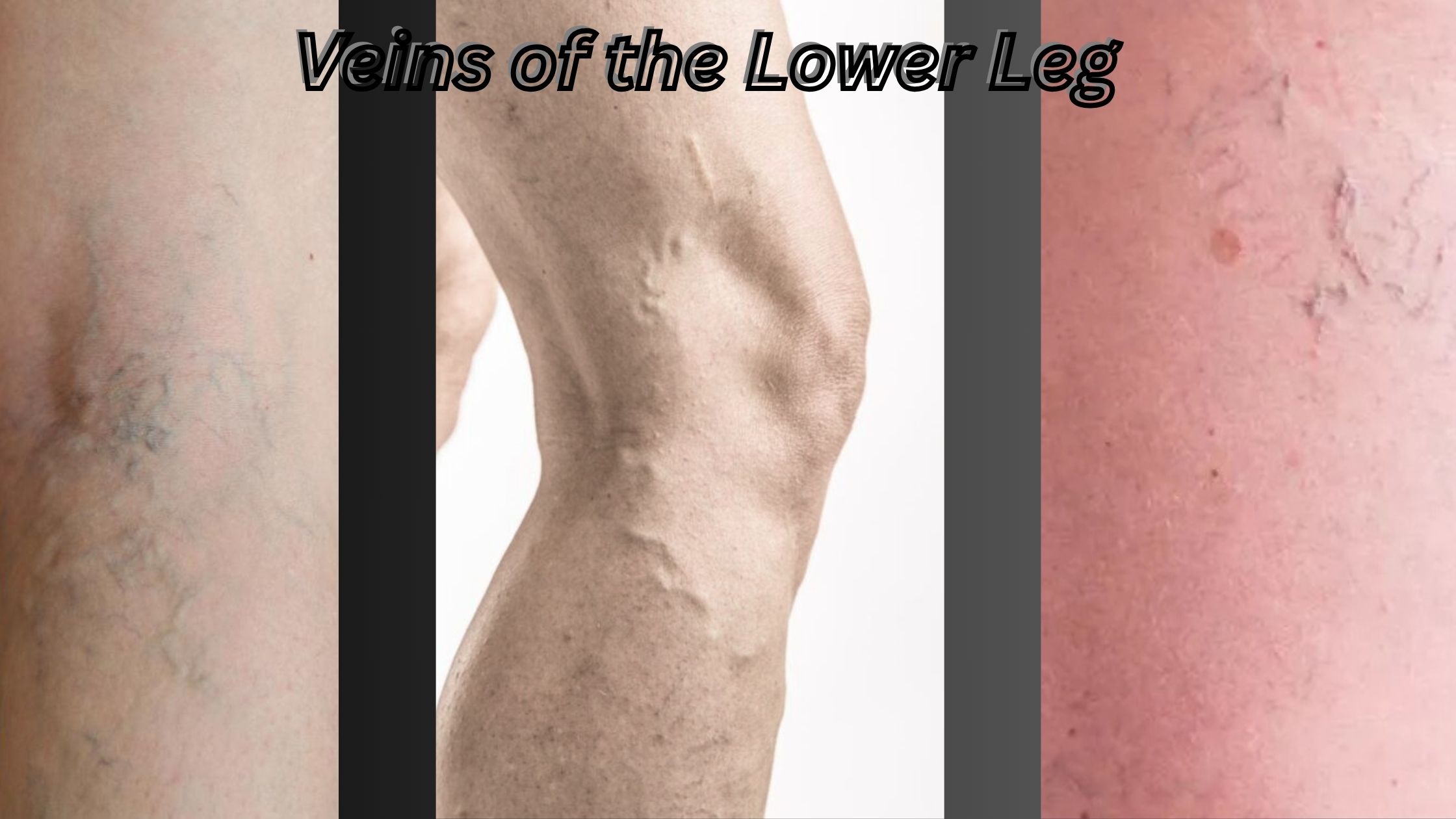 Veins of the Lower Leg