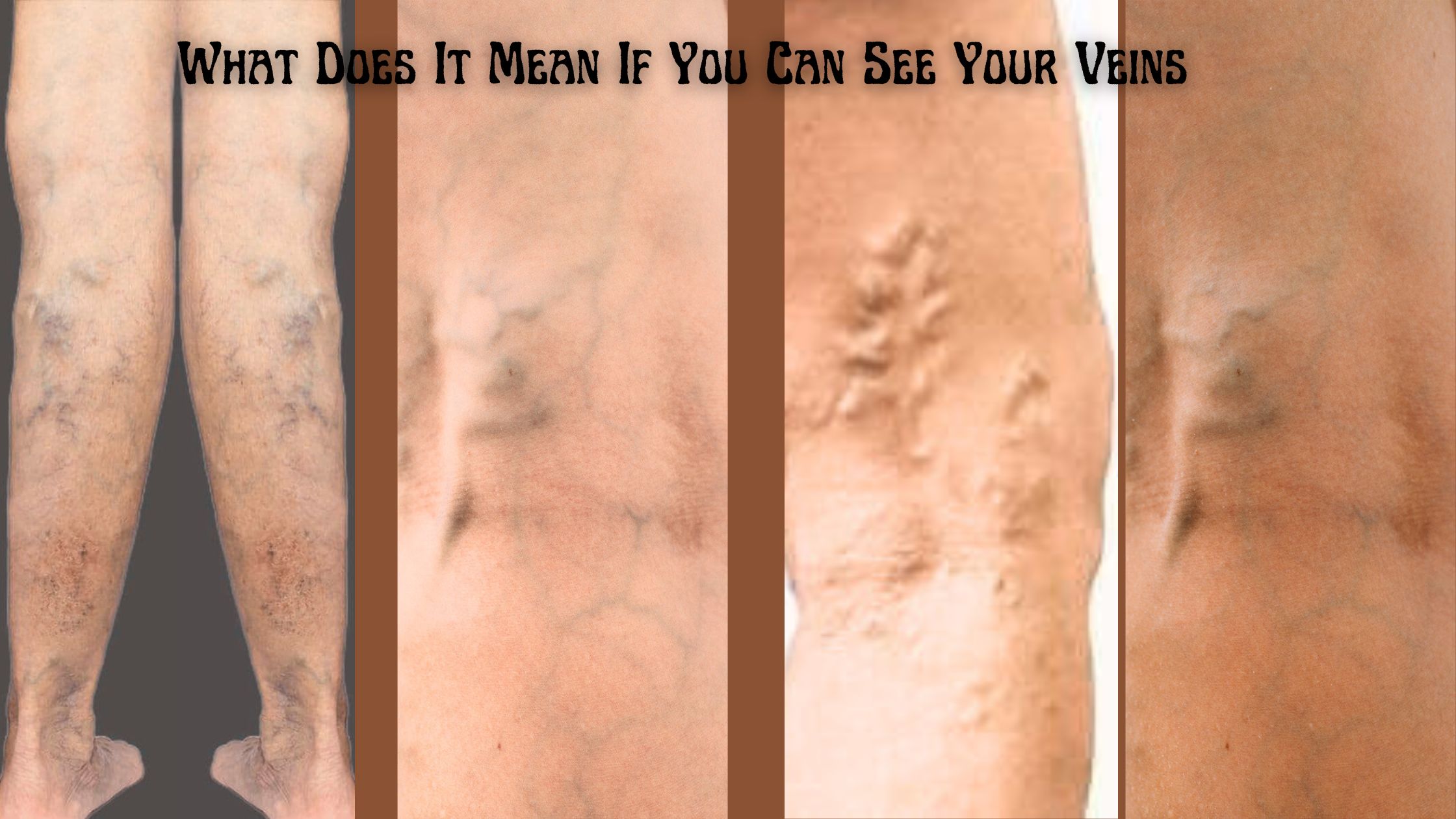 What Does It Mean If You Can See Your Veins